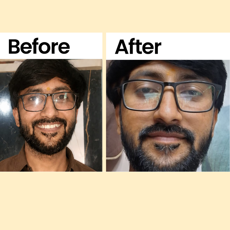 Siddharth Shinde