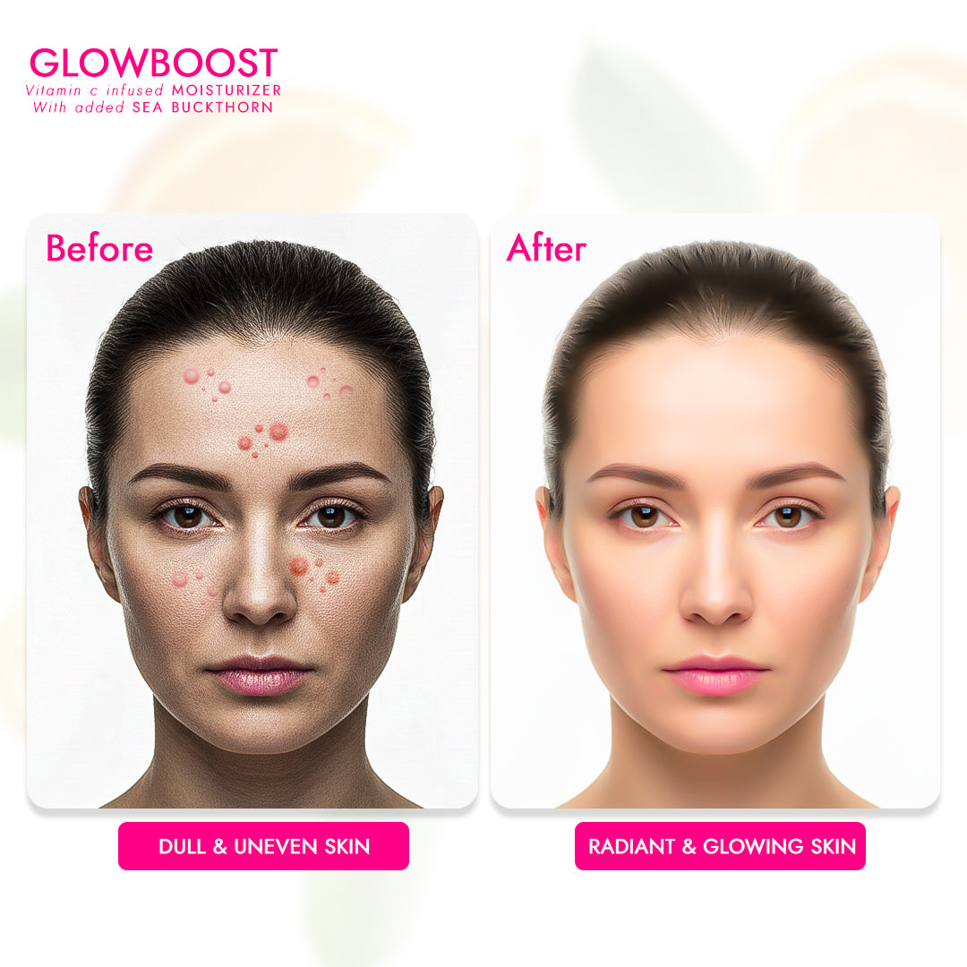 GlowBoost Vitamin C Infused Moisturizer