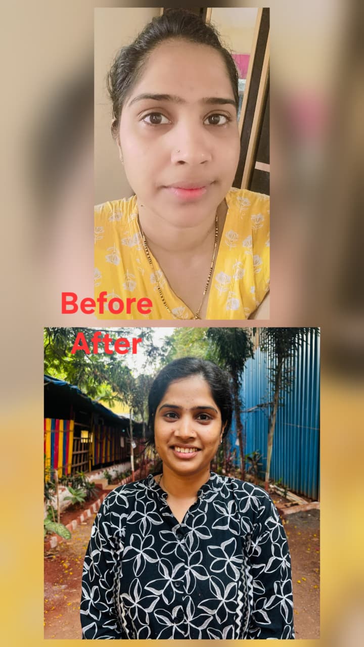 Before transformation