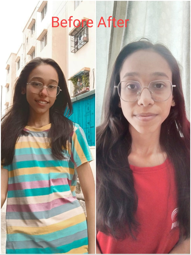 Before transformation