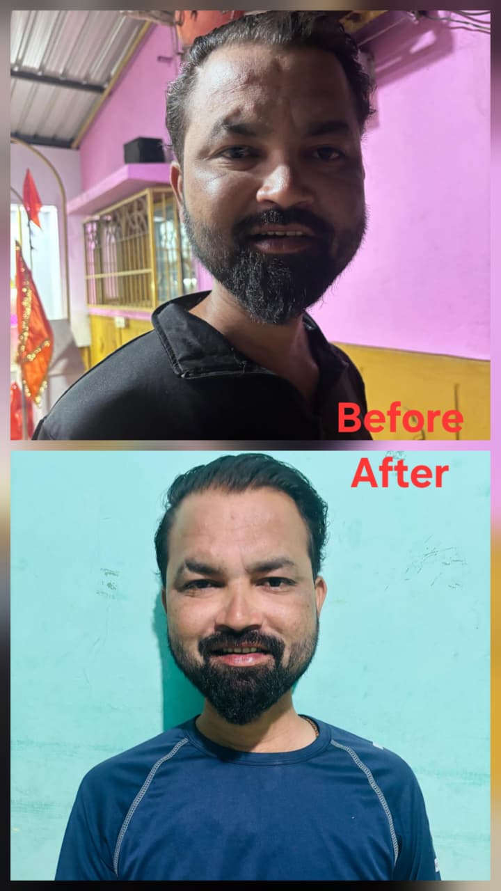 Before transformation