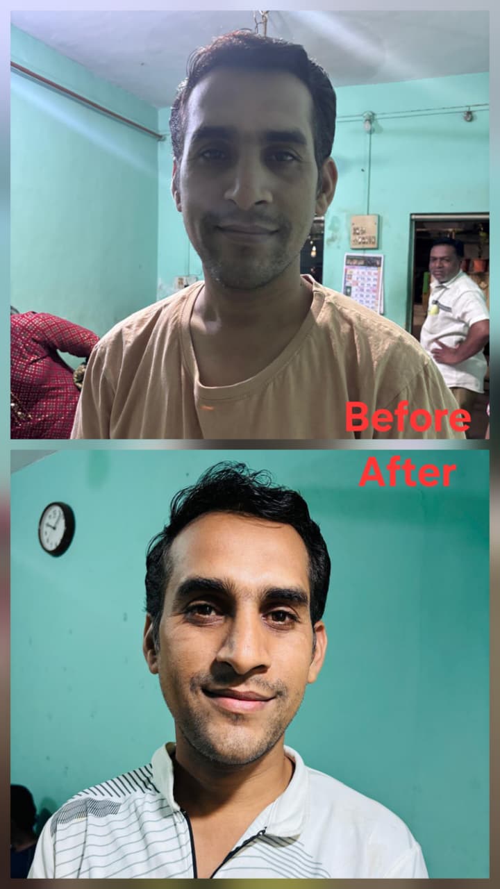 Before transformation