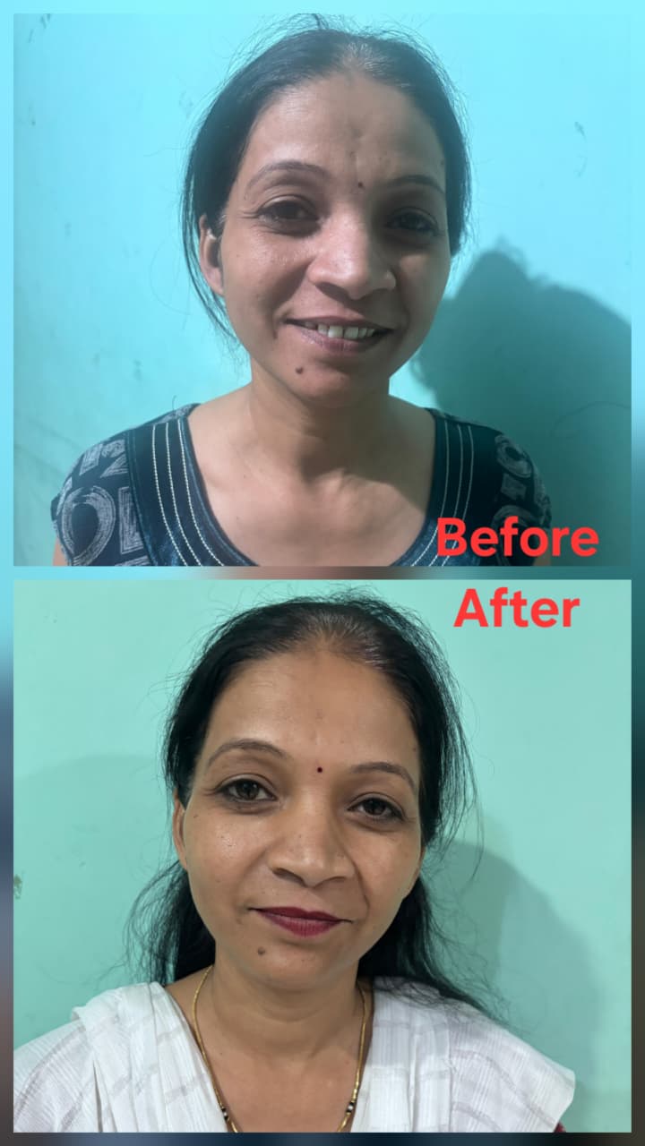Before transformation