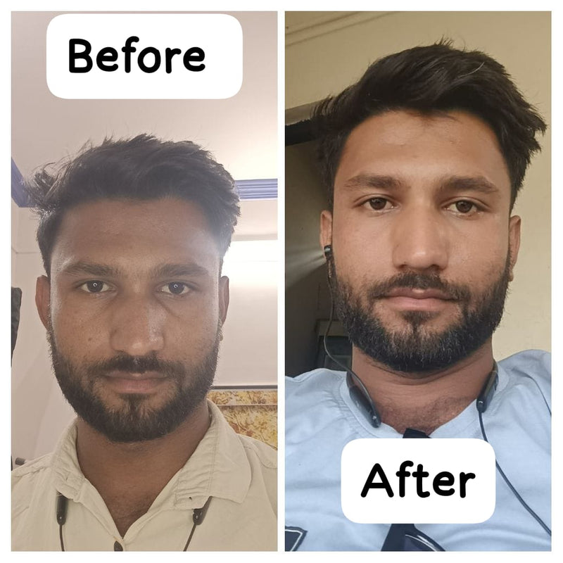 Before transformation