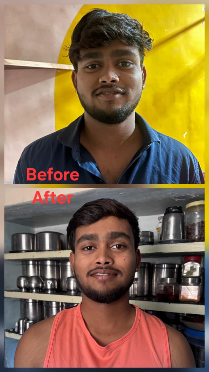 Before transformation
