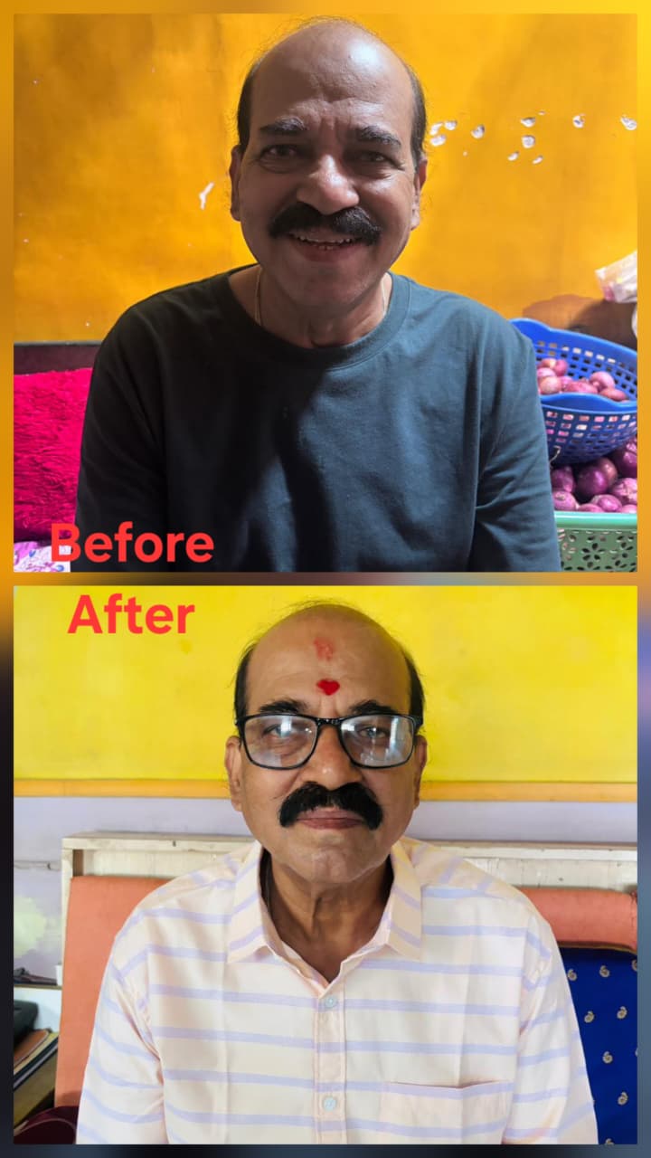 Before transformation