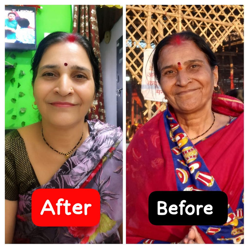 Before transformation