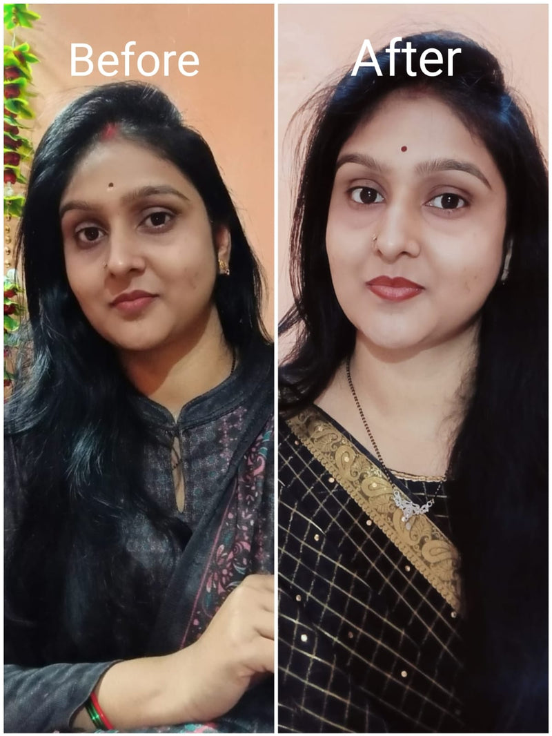 Before transformation