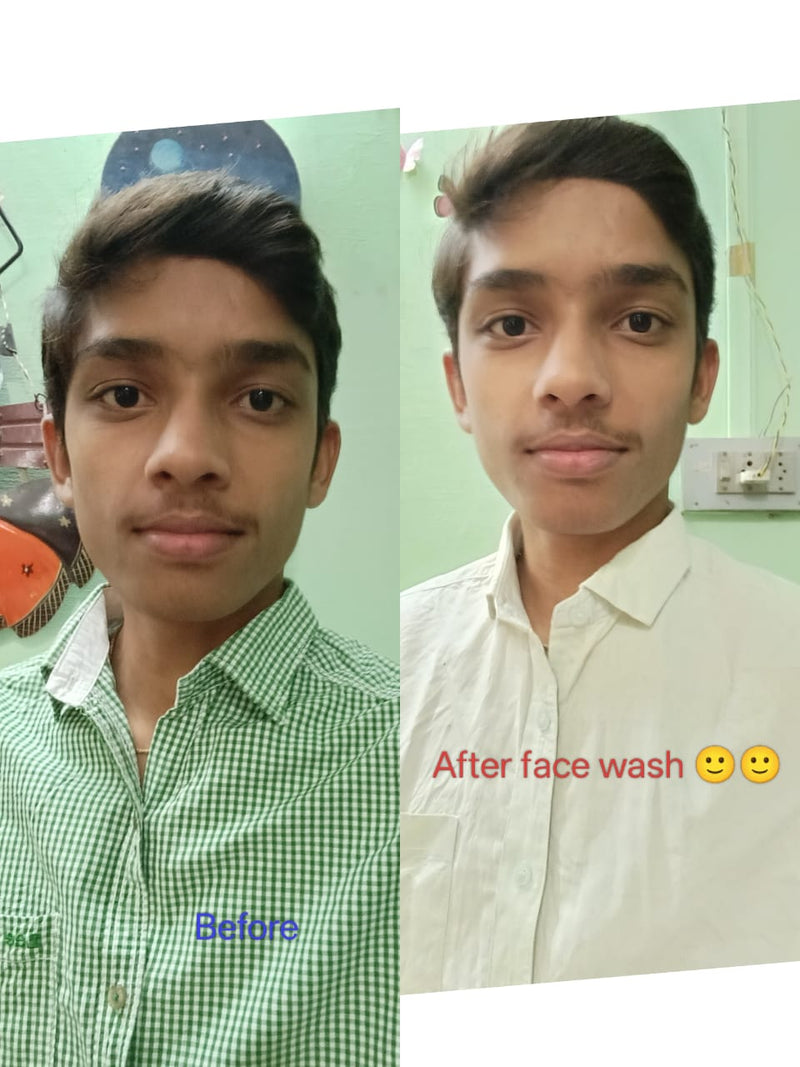 Before transformation