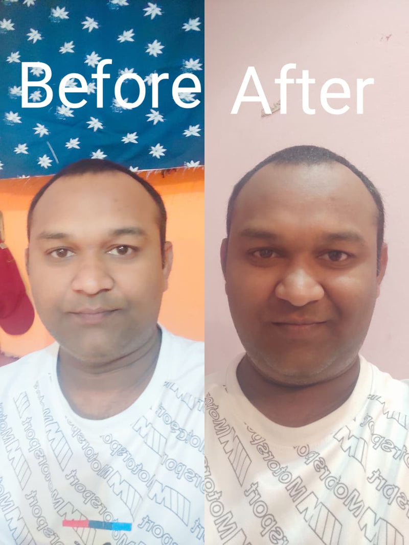 Before transformation