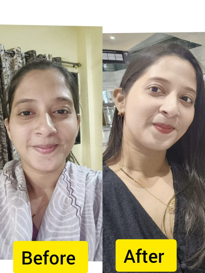 Before transformation