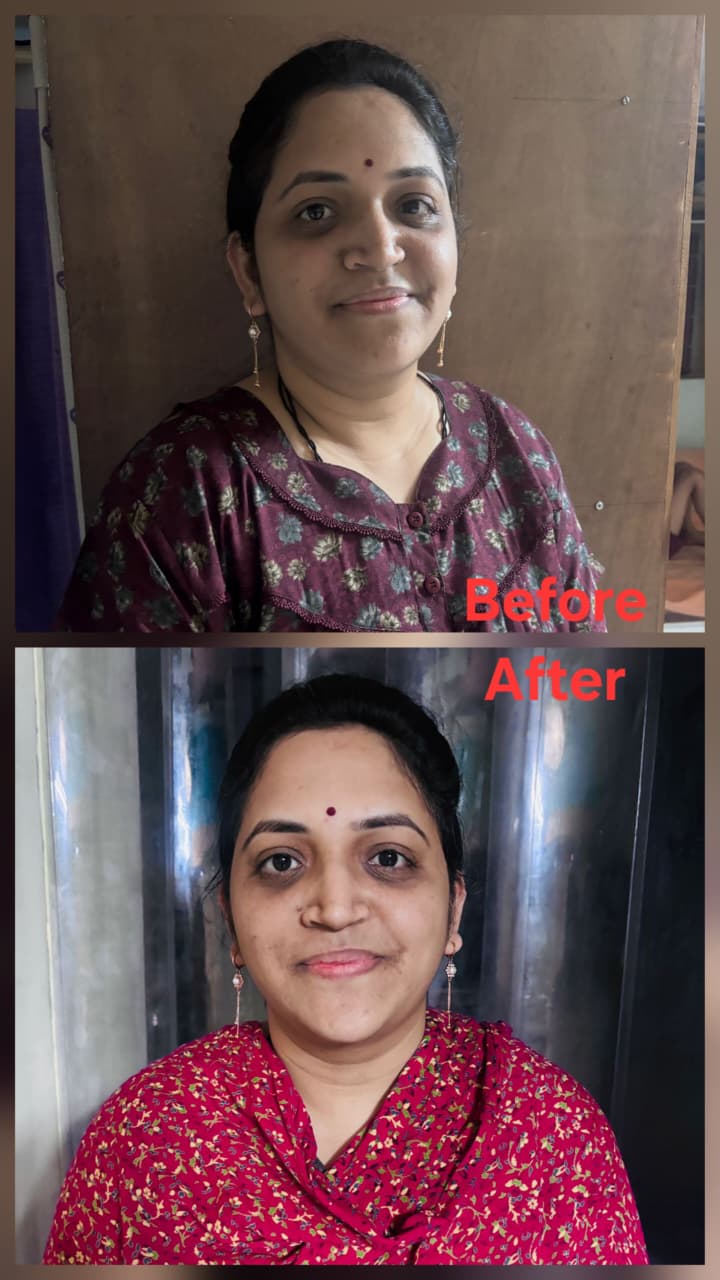 Before transformation