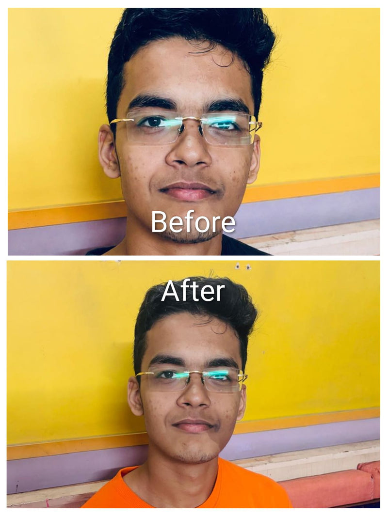 Before transformation