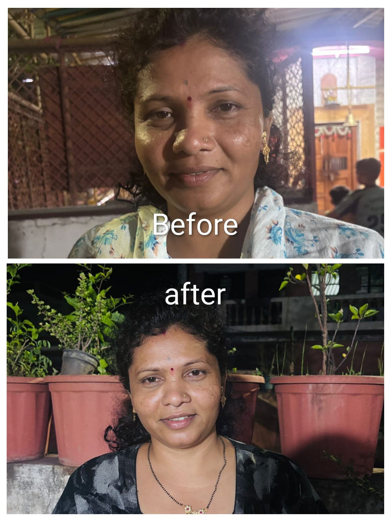 Before transformation