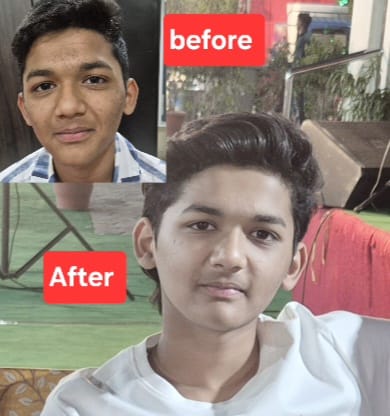Before transformation