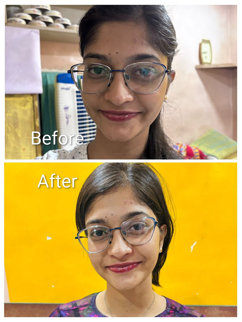 Before transformation