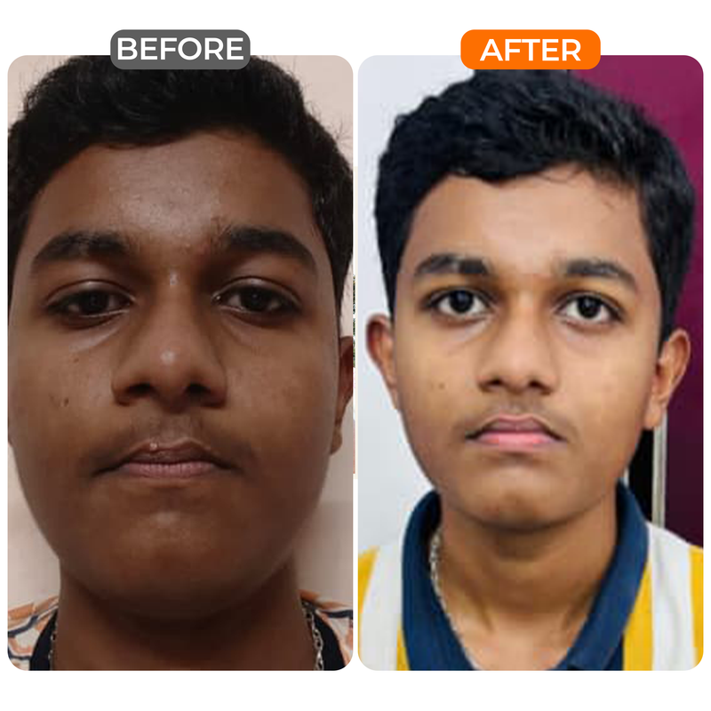 Rahul agrawal